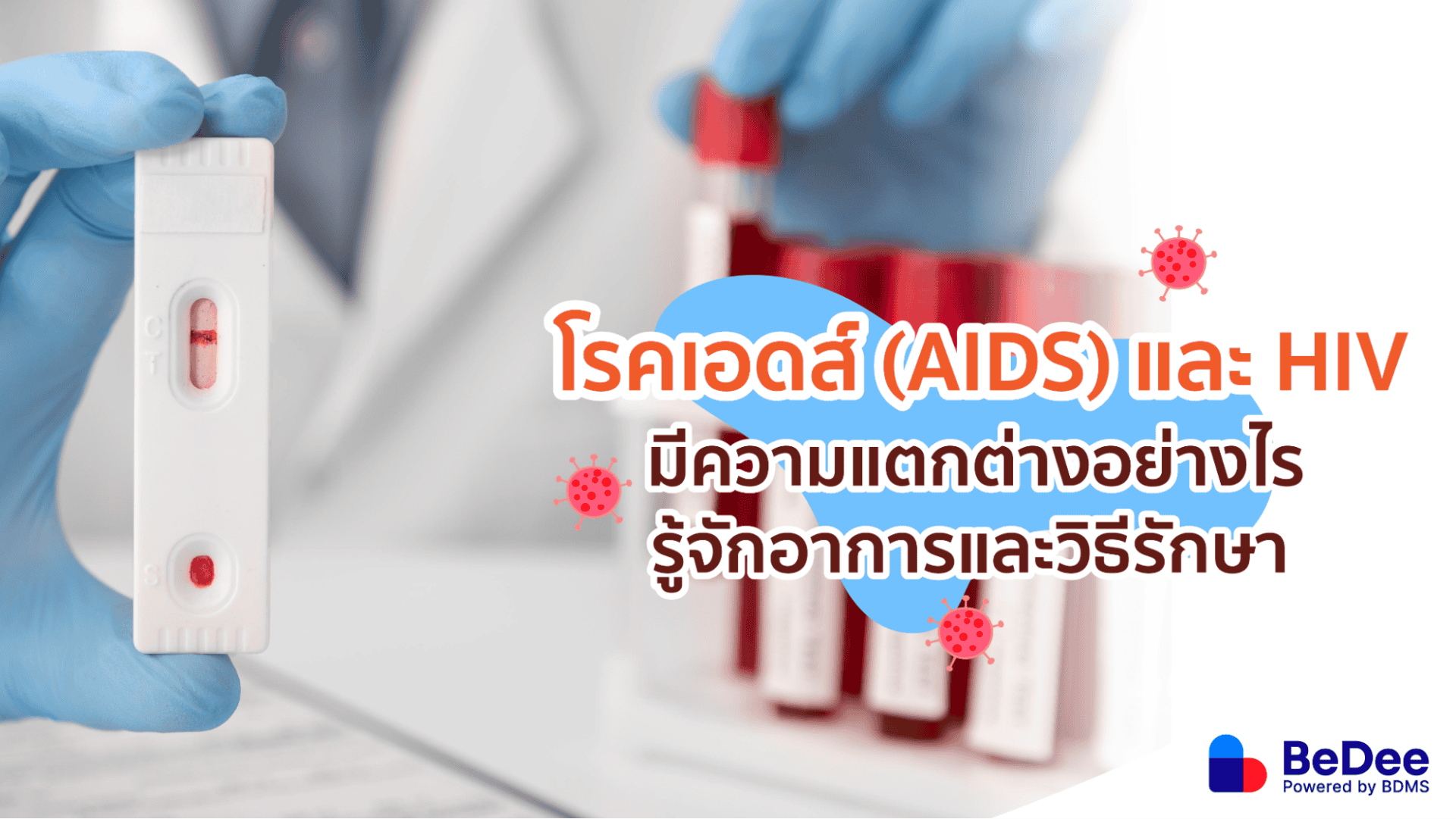 โรคเอดส์กับ HIV