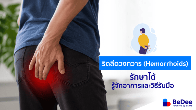 ริดสีดวงทวาร (Hemorrhoids) รักษาได้ รู้จักอาการและวิธีรับมือ - BeDee